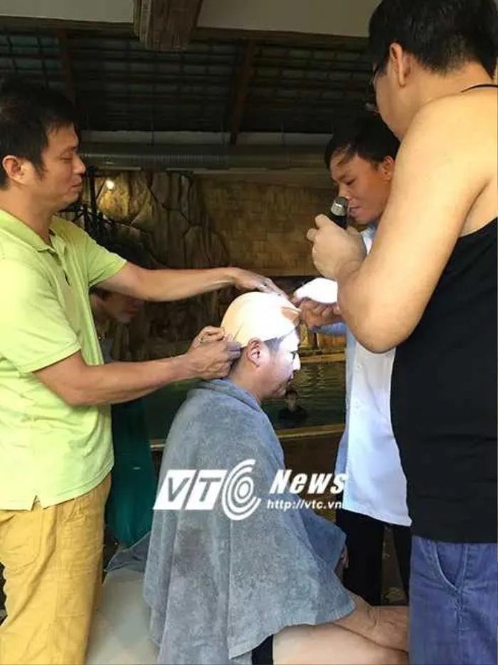 NSƯT Chí Trung phải khâu 6 mũi tại chỗ trong chuyến công tác (Ảnh: VTC)