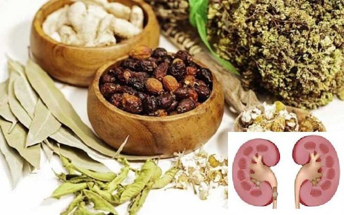 Sử dụng thuốc đông y không rõ nguồn gốc để điều trị sỏi thận đã khiến nhiều người mắc suy thận mạn.