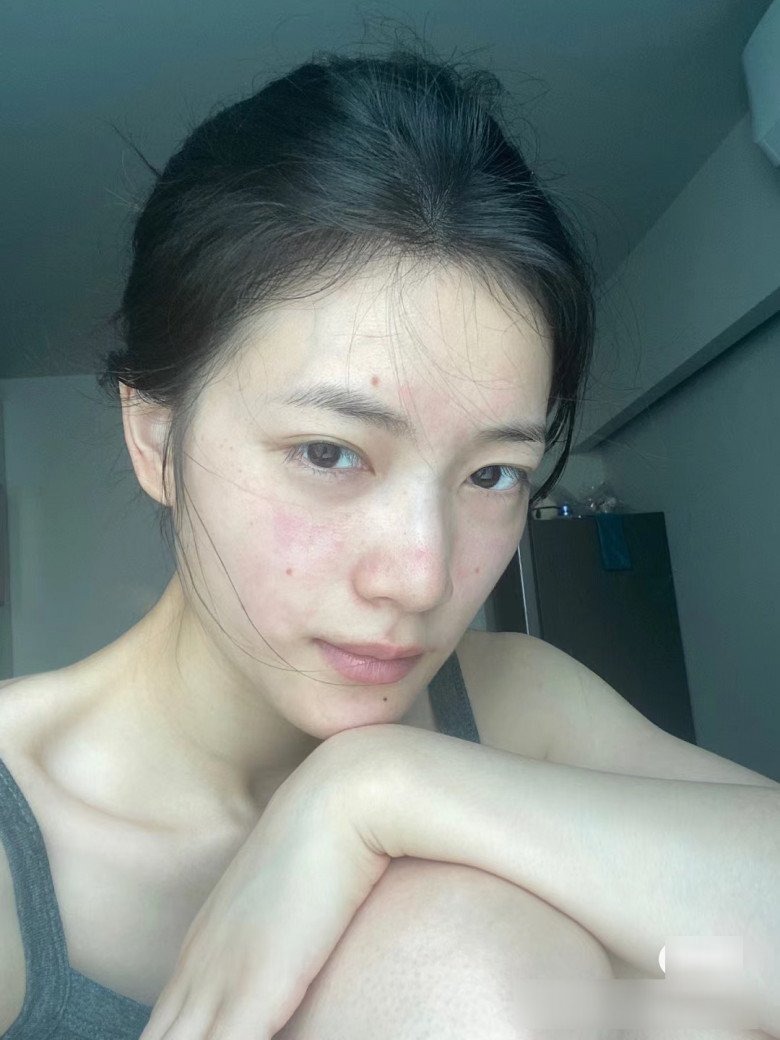 Chăm skincare mà da dẻ xấu hơn người lười dưỡng da, tất cả vì 5 sai lầm này - 3