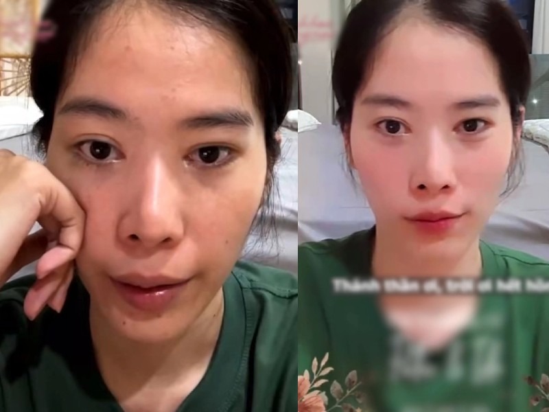 Trong những buổi livestream trước đó, không ít lần Nam Em để lộ nhan sắc tàn tạ. Cô từng lỡ tay tắt filter làm lộ mặt mộc trước ống kính. Bên cạnh làn da xỉn màu, Nam Em còn để lộ đường nét thiếu hài hòa vì phẫu thuật thẩm mỹ bị hỏng.