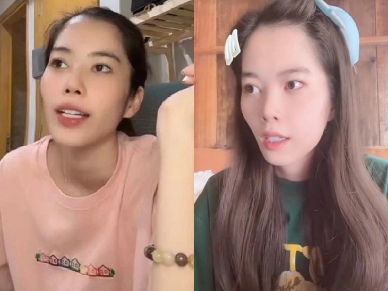 Nam Em từng cho biết cô phẫu thuật thẩm mỹ để mở góc mắt, nhấn mí, hút mỡ cằm và 2 bên má. Người đẹp Tiền Giang cũng thừa nhận phẫu thuật thẩm mỹ hỏng khiến cho nhan sắc không được ổn định.