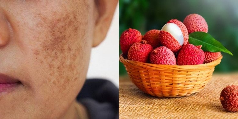 Vải thiều giàu vitamin và chất chống oxy hóa giúp làm đều màu da, giảm tình trạng tăng sắc tố.