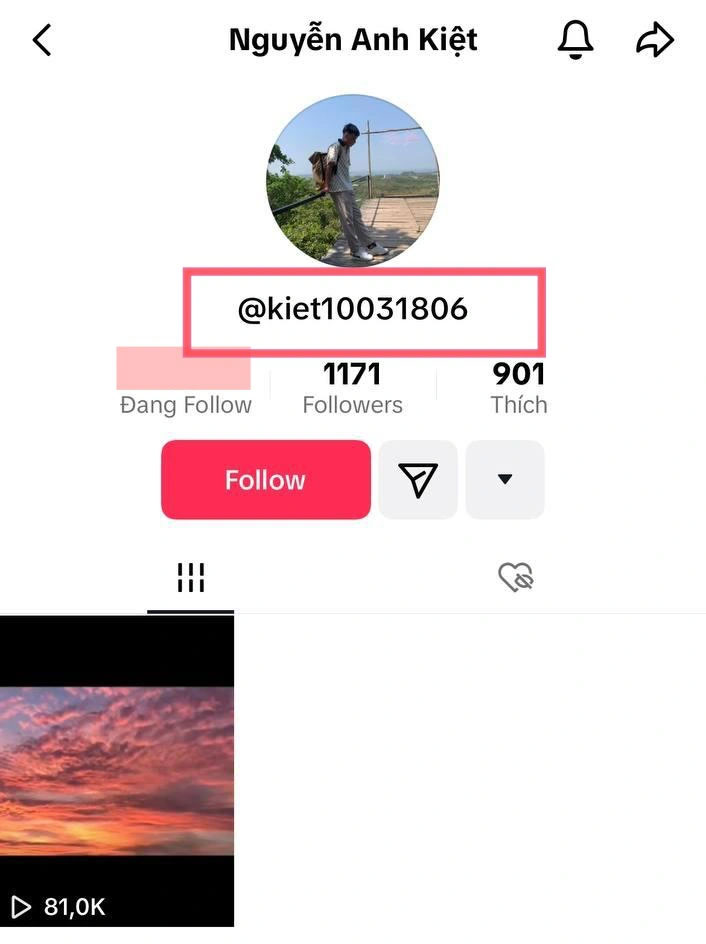 Tài khoản mạng xã hội của Anh Kiệt cũng có chi tiết liên quan đến Ý Nhi là anh dùng ngày sinh 18/6 của bạn gái khi đặt tên