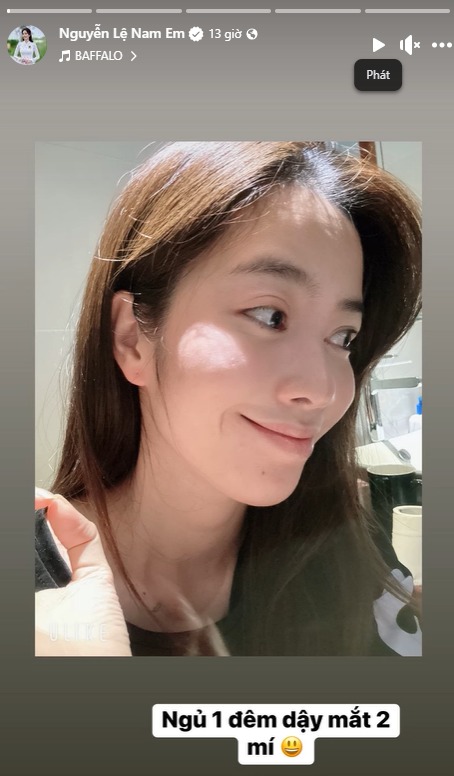 Nam Em xuất hiện với diện mạo nhợt nhạt, gầy gò trong bức hình mới.