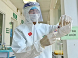 Ảnh minh họa