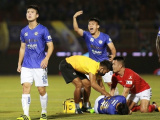 Ảnh minh họa