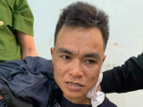 Ảnh minh họa