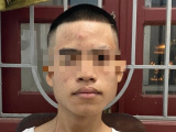 Ảnh minh họa