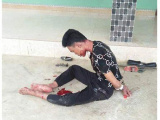 Ảnh minh họa