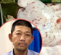 Ảnh minh họa