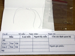 Ảnh bìa bài viết 623007