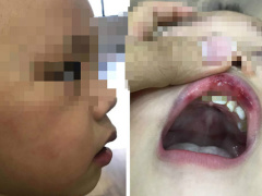 Ảnh bìa bài viết 625619