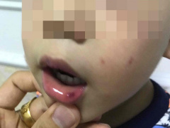 Ảnh bìa bài viết 625817