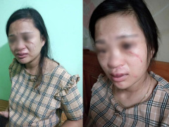 Ảnh bìa bài viết 633218