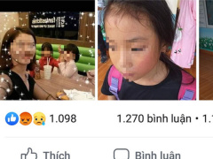 Ảnh bìa bài viết 633562