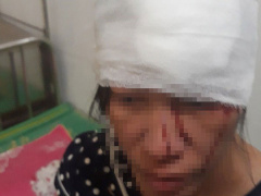 Ảnh bìa bài viết 636774