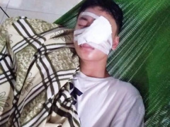 Ảnh bìa bài viết 637380