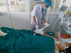 Ảnh bìa bài viết 641566