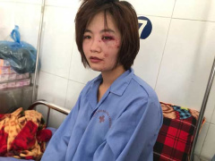 Ảnh bìa bài viết 649597