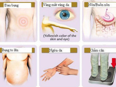 Ảnh bìa bài viết 650785