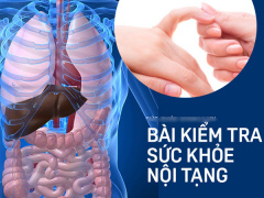 Ảnh bìa bài viết 652967