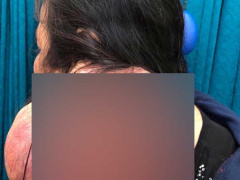 Ảnh bìa bài viết 656344