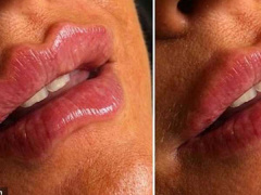 Ảnh bìa bài viết 659136