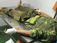 Ảnh bìa bài viết 659313