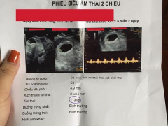 Ảnh bìa bài viết 661048