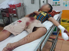 Ảnh bìa bài viết 662801