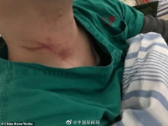 Ảnh bìa bài viết 664530
