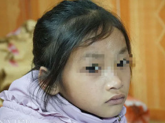 Ảnh bìa bài viết 667352