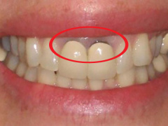 Ảnh bìa bài viết 668532