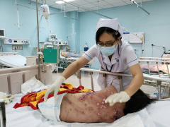 Ảnh bìa bài viết 671466