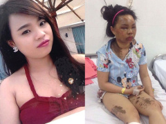 Ảnh bìa bài viết 676890