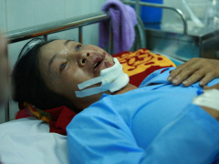 Ảnh bìa bài viết 681229