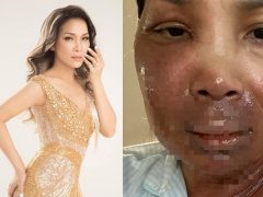 Ảnh bìa bài viết 682793