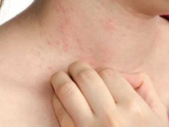 Ảnh bìa bài viết 686355