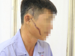 Ảnh bìa bài viết 689346