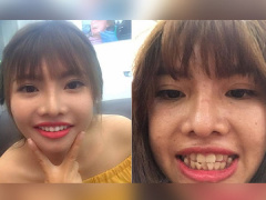 Ảnh bìa bài viết 690294