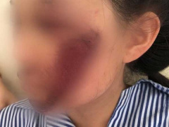 Ảnh bìa bài viết 691802
