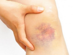 Ảnh bìa bài viết 696363