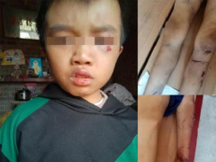 Ảnh bìa bài viết 698285