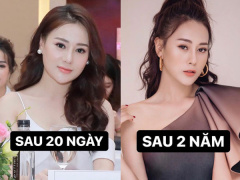 Ảnh bìa bài viết 699781