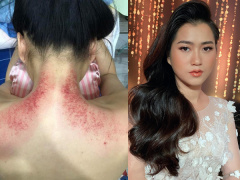 Ảnh bìa bài viết 705470