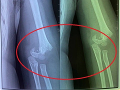 Ảnh bìa bài viết 706996