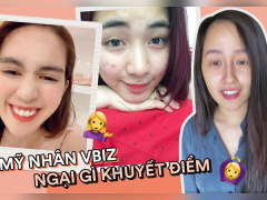 Ảnh bìa bài viết 708085
