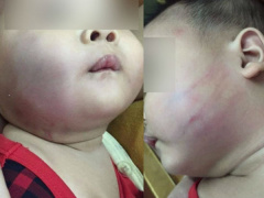 Ảnh bìa bài viết 709440