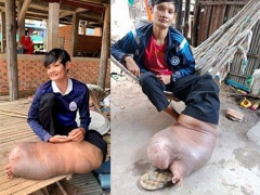 Ảnh bìa bài viết 709877