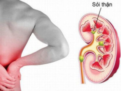 Ảnh bìa bài viết 713393